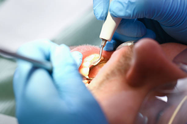 Best Emergency Dental Care for Broken or Chipped Teeth in Westminster, SC